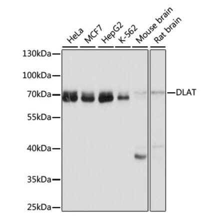 Western Blot - Anti-Pyruvate Dehydrogenase E2 Antibody (A90937) - Antibodies.com