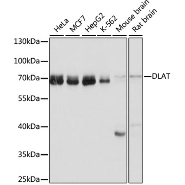 Western Blot - Anti-Pyruvate Dehydrogenase E2 Antibody (A90937) - Antibodies.com