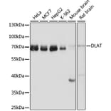 Western Blot - Anti-Pyruvate Dehydrogenase E2 Antibody (A90937) - Antibodies.com