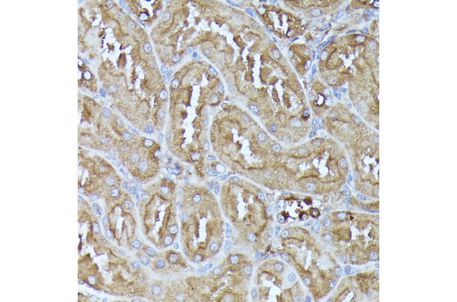 Immunohistochemistry - Anti-Pyruvate Dehydrogenase E2 Antibody (A90937) - Antibodies.com