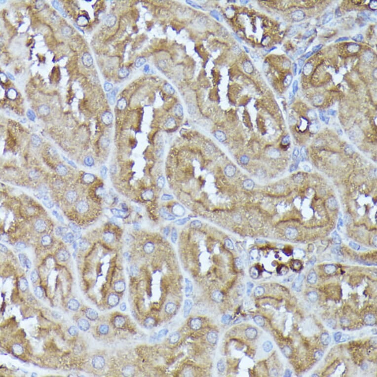Immunohistochemistry - Anti-Pyruvate Dehydrogenase E2 Antibody (A90937) - Antibodies.com