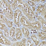 Immunohistochemistry - Anti-Pyruvate Dehydrogenase E2 Antibody (A90937) - Antibodies.com