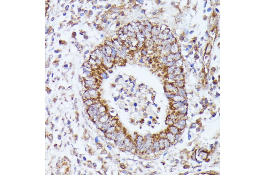 Immunohistochemistry - Anti-Pyruvate Dehydrogenase E2 Antibody (A90937) - Antibodies.com