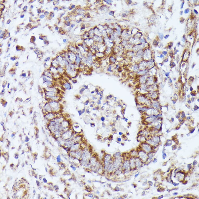 Immunohistochemistry - Anti-Pyruvate Dehydrogenase E2 Antibody (A90937) - Antibodies.com
