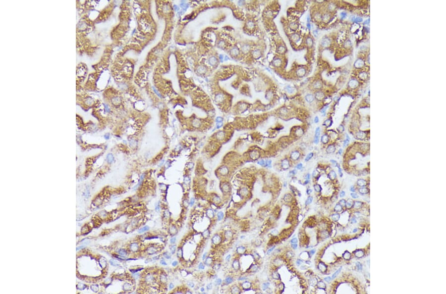Immunohistochemistry - Anti-Pyruvate Dehydrogenase E2 Antibody (A90937) - Antibodies.com