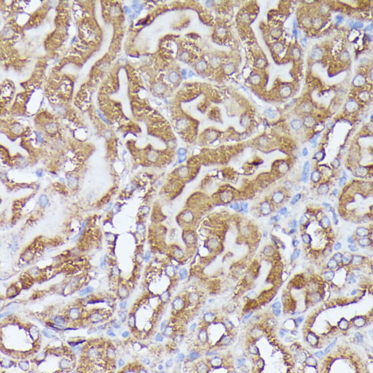 Immunohistochemistry - Anti-Pyruvate Dehydrogenase E2 Antibody (A90937) - Antibodies.com