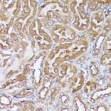 Immunohistochemistry - Anti-Pyruvate Dehydrogenase E2 Antibody (A90937) - Antibodies.com