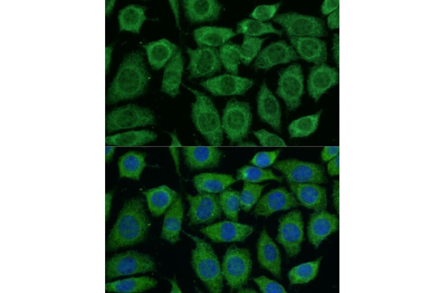 Immunofluorescence - Anti-Pyruvate Dehydrogenase E2 Antibody (A90937) - Antibodies.com