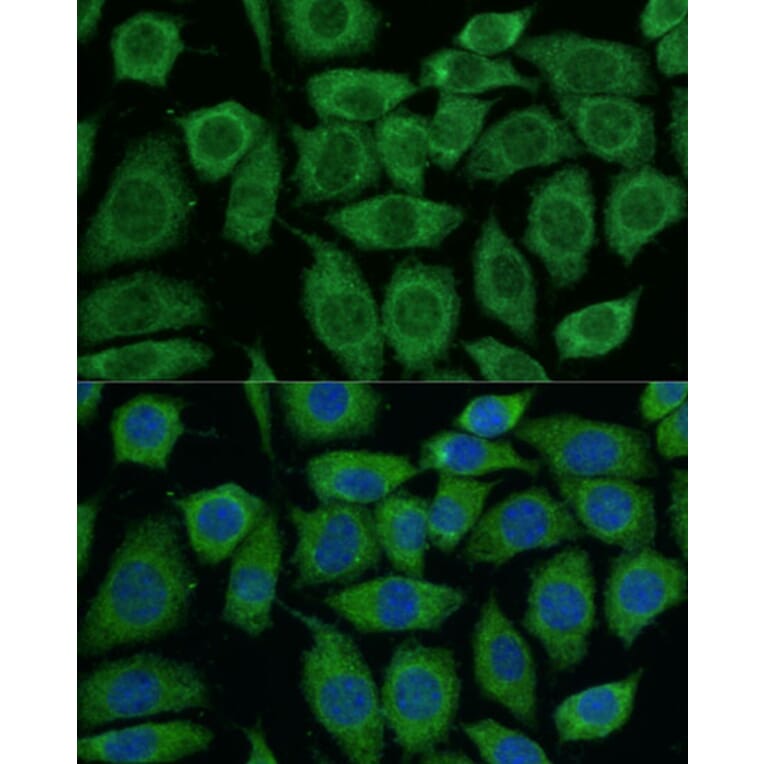 Immunofluorescence - Anti-Pyruvate Dehydrogenase E2 Antibody (A90937) - Antibodies.com