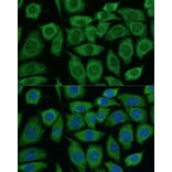 Immunofluorescence - Anti-Pyruvate Dehydrogenase E2 Antibody (A90937) - Antibodies.com