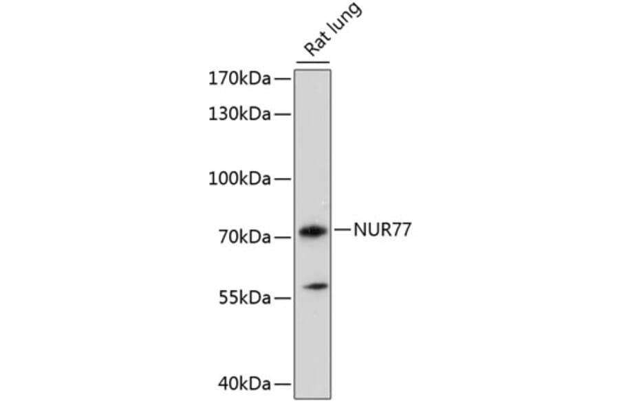 Western Blot - Anti-NUR77 Antibody (A90939) - Antibodies.com