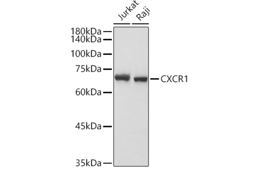 Western Blot - Anti-CXCR1 Antibody (A90940) - Antibodies.com