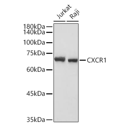 Western Blot - Anti-CXCR1 Antibody (A90940) - Antibodies.com