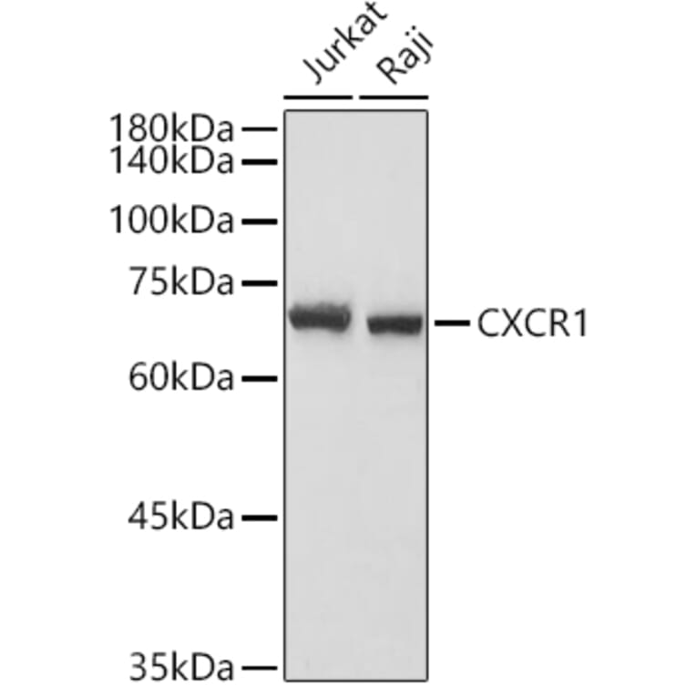 Western Blot - Anti-CXCR1 Antibody (A90940) - Antibodies.com