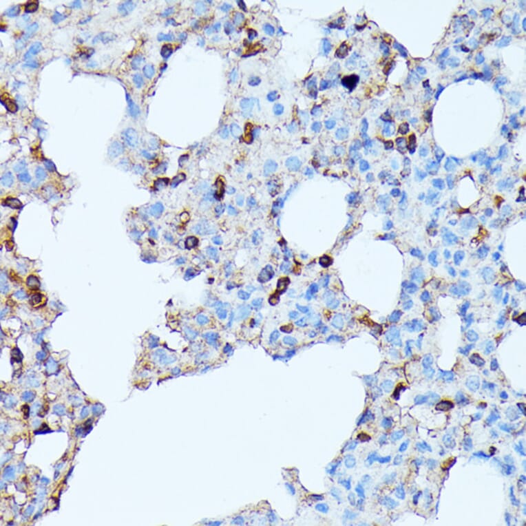 Immunohistochemistry - Anti-CXCR1 Antibody (A90940) - Antibodies.com