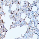 Immunohistochemistry - Anti-CXCR1 Antibody (A90940) - Antibodies.com