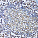 Immunohistochemistry - Anti-CXCR1 Antibody (A90940) - Antibodies.com