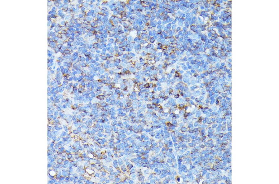 Immunohistochemistry - Anti-CXCR1 Antibody (A90940) - Antibodies.com