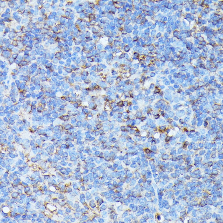 Immunohistochemistry - Anti-CXCR1 Antibody (A90940) - Antibodies.com