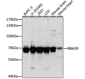 Western Blot - Anti-HCC1 Antibody (A90941) - Antibodies.com