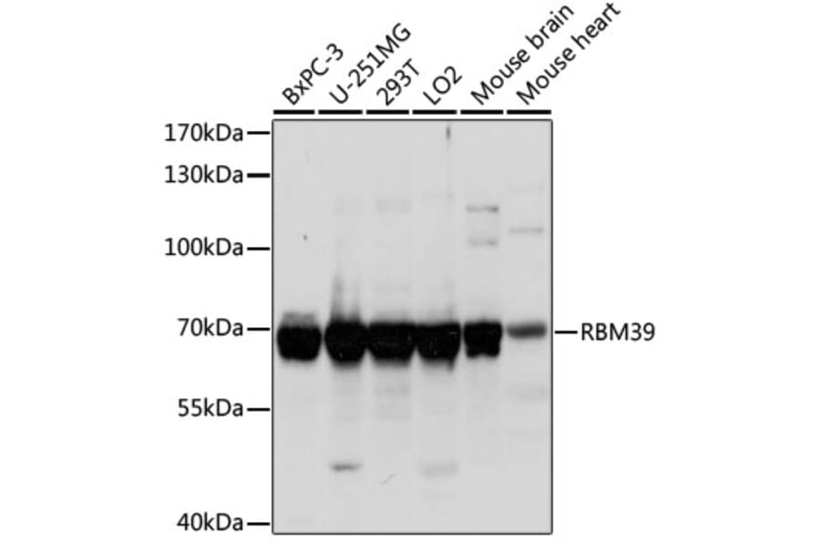 Western Blot - Anti-HCC1 Antibody (A90941) - Antibodies.com