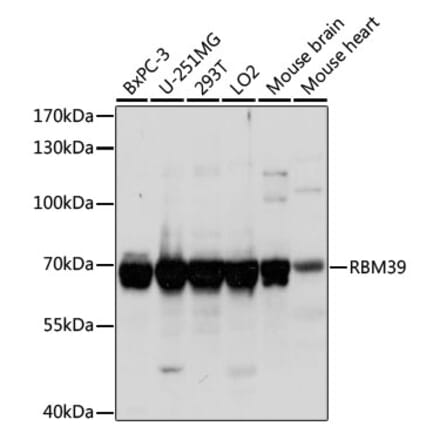 Western Blot - Anti-HCC1 Antibody (A90941) - Antibodies.com