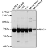 Western Blot - Anti-HCC1 Antibody (A90941) - Antibodies.com