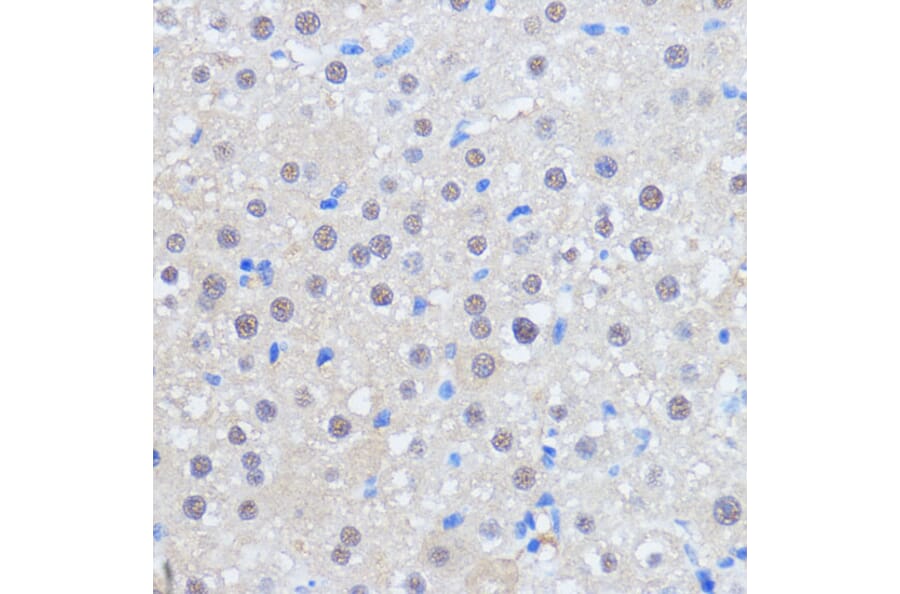 Immunohistochemistry - Anti-HCC1 Antibody (A90941) - Antibodies.com