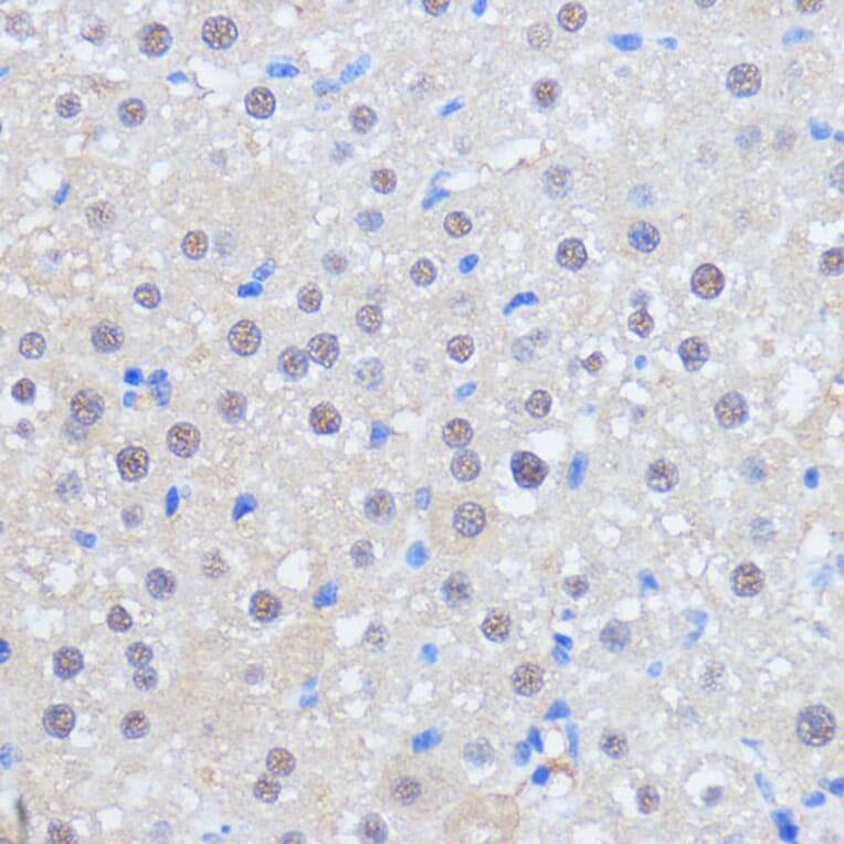 Immunohistochemistry - Anti-HCC1 Antibody (A90941) - Antibodies.com