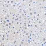 Immunohistochemistry - Anti-HCC1 Antibody (A90941) - Antibodies.com