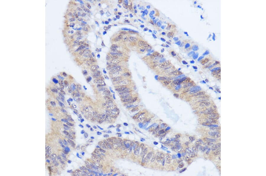 Immunohistochemistry - Anti-HCC1 Antibody (A90941) - Antibodies.com