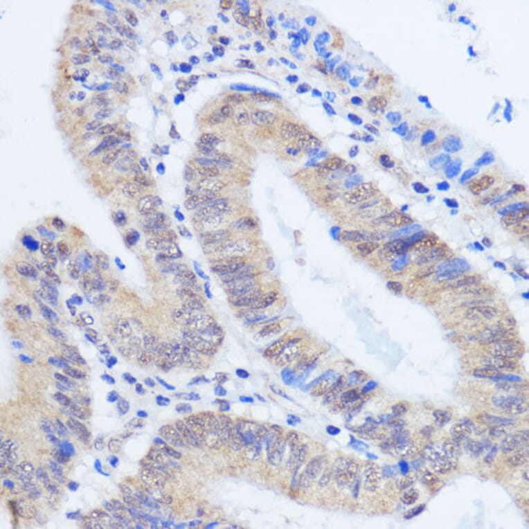 Immunohistochemistry - Anti-HCC1 Antibody (A90941) - Antibodies.com