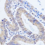 Immunohistochemistry - Anti-HCC1 Antibody (A90941) - Antibodies.com