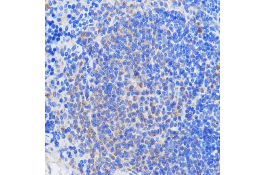 Immunohistochemistry - Anti-HCC1 Antibody (A90941) - Antibodies.com