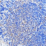 Immunohistochemistry - Anti-HCC1 Antibody (A90941) - Antibodies.com