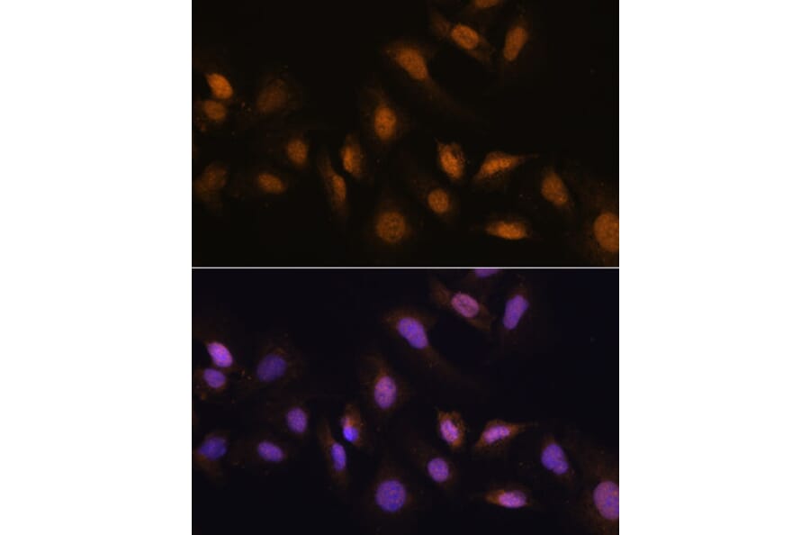 Immunofluorescence - Anti-HCC1 Antibody (A90941) - Antibodies.com