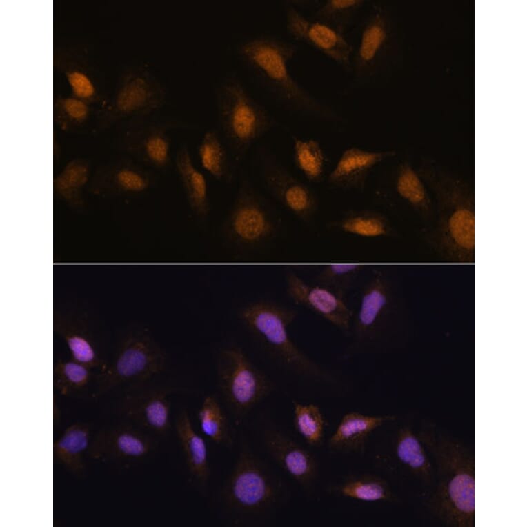 Immunofluorescence - Anti-HCC1 Antibody (A90941) - Antibodies.com