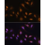 Immunofluorescence - Anti-HCC1 Antibody (A90941) - Antibodies.com