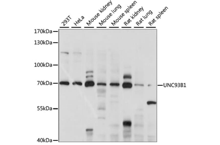 Western Blot - Anti-UNC93B1 Antibody (A90942) - Antibodies.com