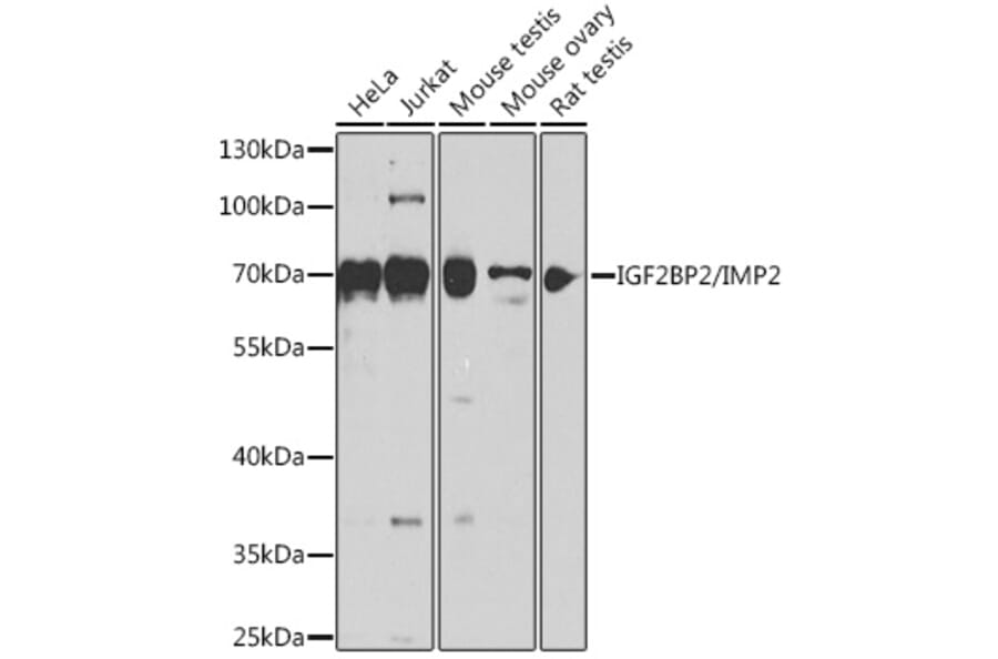 Western Blot - Anti-IGF2BP2/IMP-2 Antibody (A90943) - Antibodies.com