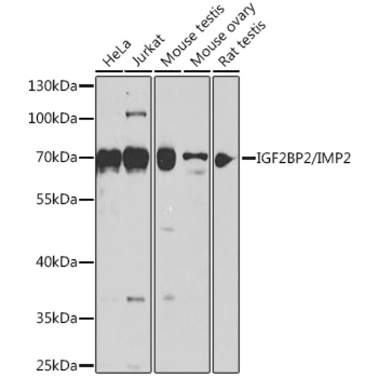 Western Blot - Anti-IGF2BP2/IMP-2 Antibody (A90943) - Antibodies.com