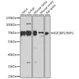 Western Blot - Anti-IGF2BP2/IMP-2 Antibody (A90943) - Antibodies.com