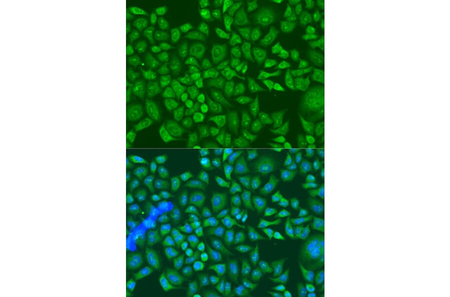Immunofluorescence - Anti-IGF2BP2/IMP-2 Antibody (A90943) - Antibodies.com