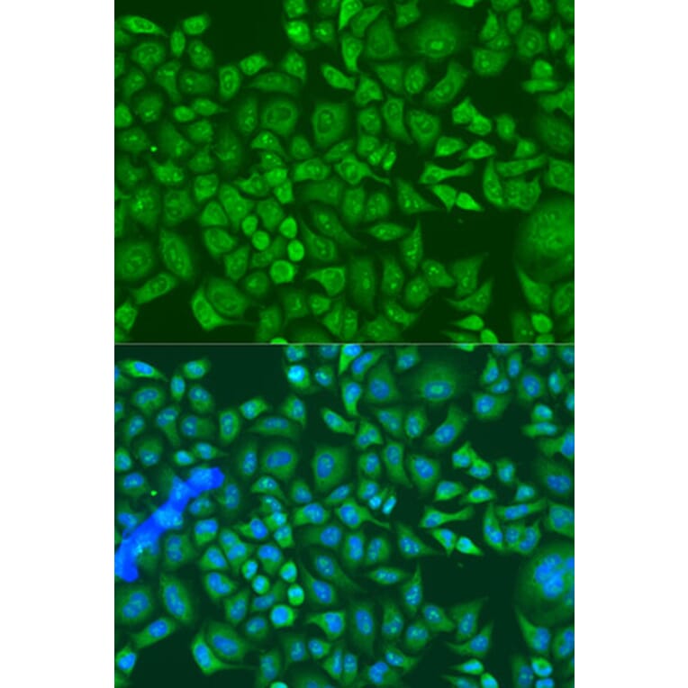 Immunofluorescence - Anti-IGF2BP2/IMP-2 Antibody (A90943) - Antibodies.com