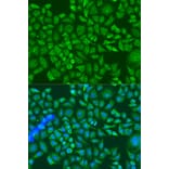 Immunofluorescence - Anti-IGF2BP2/IMP-2 Antibody (A90943) - Antibodies.com