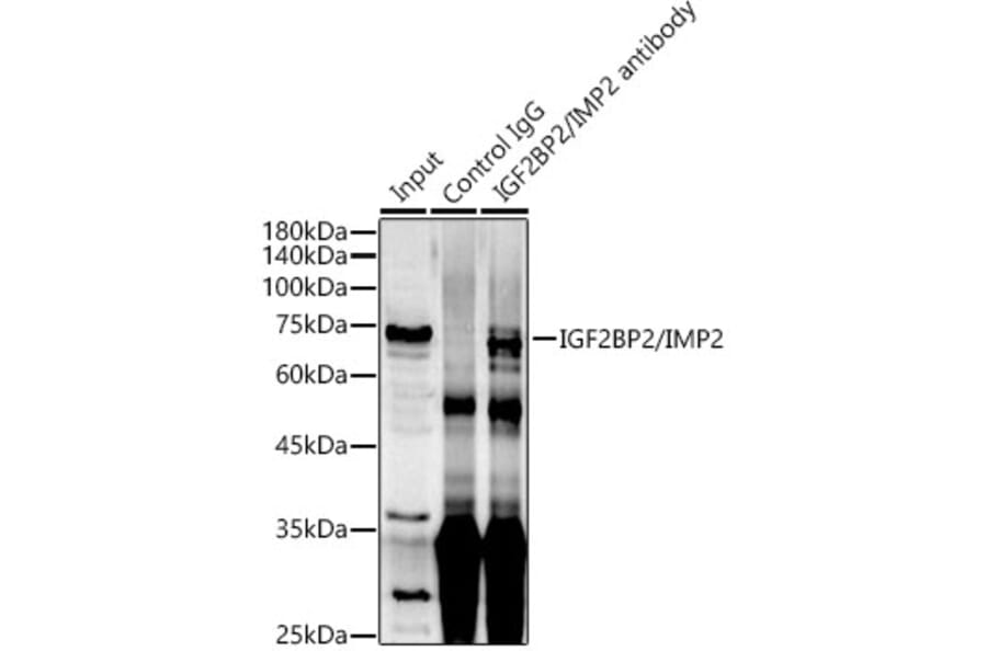Western Blot - Anti-IGF2BP2/IMP-2 Antibody (A90943) - Antibodies.com