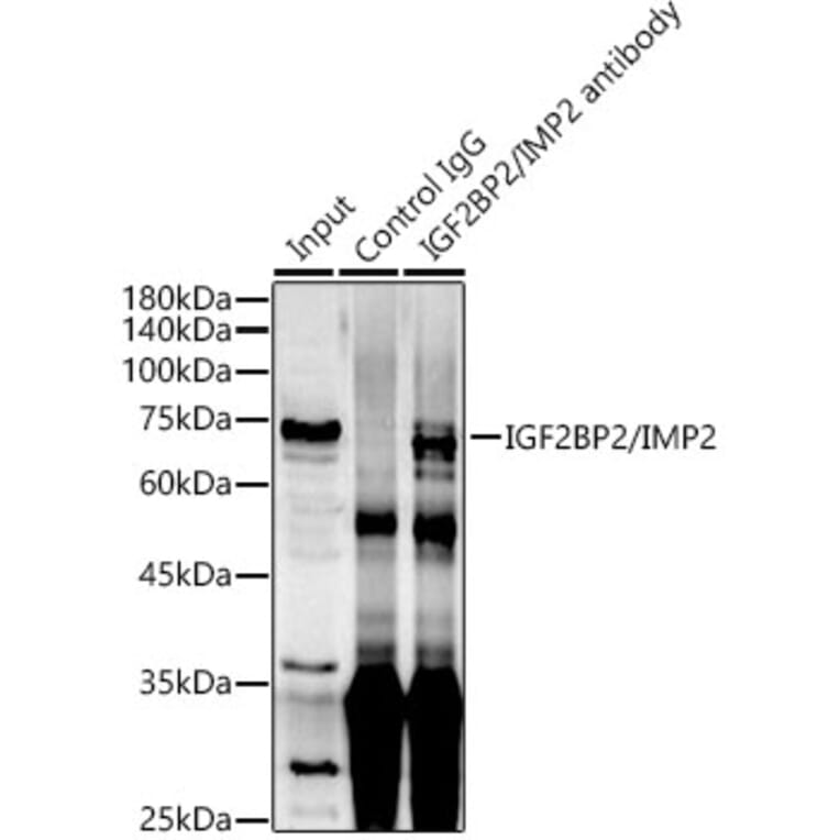 Western Blot - Anti-IGF2BP2/IMP-2 Antibody (A90943) - Antibodies.com