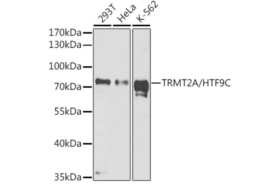 Western Blot - Anti-HTF9C/TRMT2A Antibody (A90944) - Antibodies.com