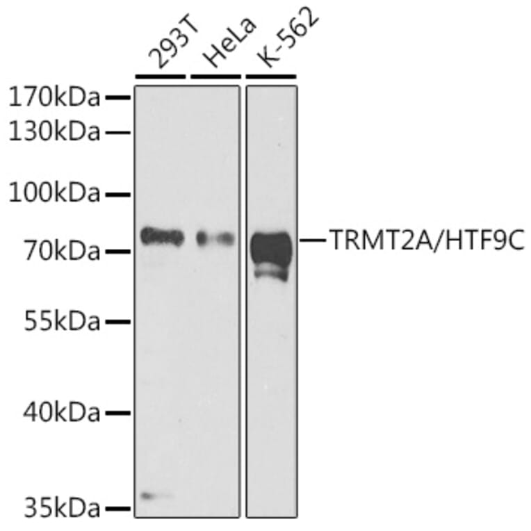 Western Blot - Anti-HTF9C/TRMT2A Antibody (A90944) - Antibodies.com