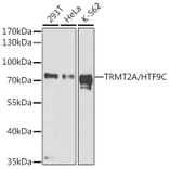 Western Blot - Anti-HTF9C/TRMT2A Antibody (A90944) - Antibodies.com